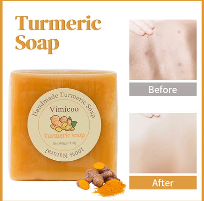 Turmeric Soap Handmade Soap with Intensive Skin Nourishment